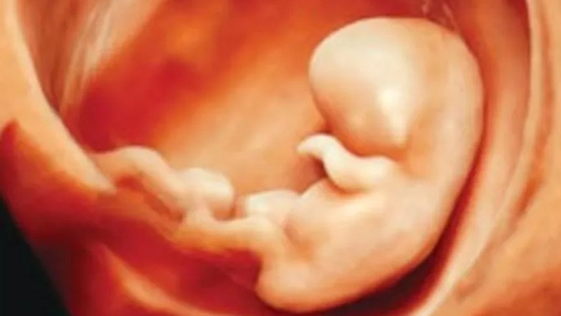 Kürtaj karşıtı kadının evinden beş adet fetüs çıktı