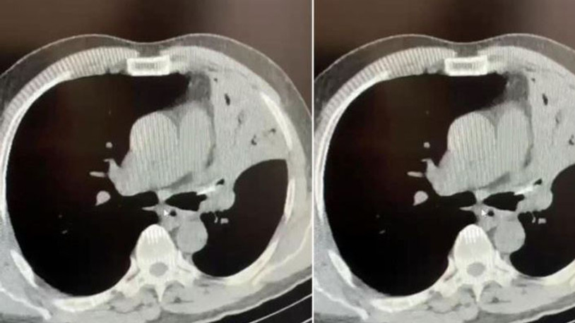 Öksürük şikayetiyle gitti, hastanede şok gerçekle yüzleşti