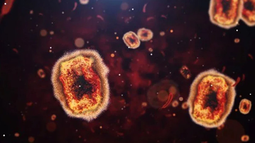 DSÖ'den maymun çiçeği ile ilgili bir iyi, bir de kötü haber