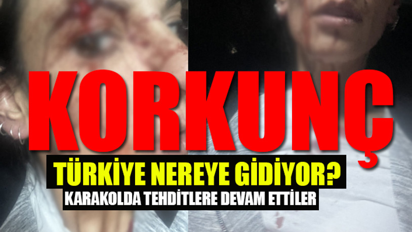 Bahçeşehir'de kadınlara 4-5 kişilik grup 'bira içiyorsunuz' diyerek saldırdı