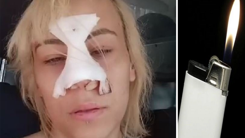 Çakmak istedi; olumsuz yanıt alınca genç kadına kafa attı