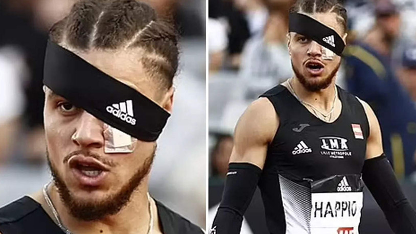 Fransız atlet önce saldırıya uğradı sonra yarışı kazandı