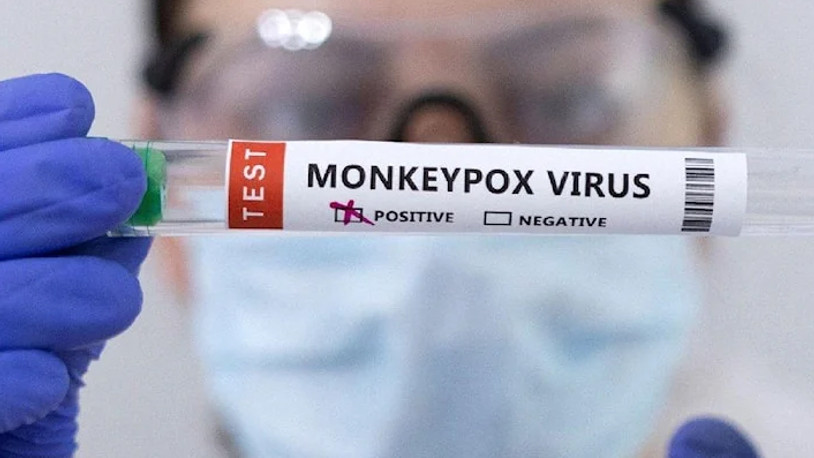 Komşuda ilk maymun çiçeği vakası görüldü