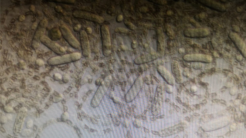 Türkiye'nin en büyük 5. gölüne girmek yasaklandı: Kanser saçıyor