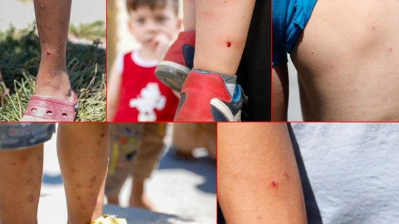 İstanbul’da sivrisinekler tehlike saçıyor: Zika virüsü alarmı