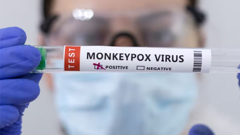 Maymun çiçeği için kırmızı alarm: ABD'de acil durum ilan edildi