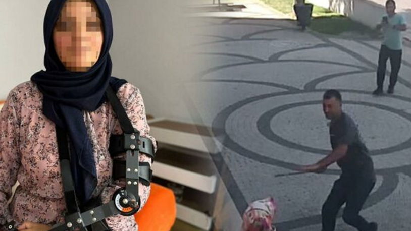 Eşi tarafından demir sopayla saldırıya uğrayan kadın: Arkadaşı ile grup seks teklif etti