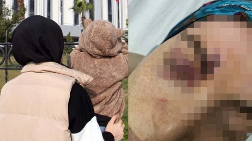Eşinin cinsel ilişki teklifini reddedince darp edilmişti: Devlet korumasına alındı