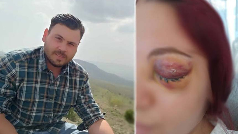 Alıkoyduğu kadını dövdü, cinsel saldırıda bulundu, serbest kaldı: Ailem külliyede, bana bir şey olmaz