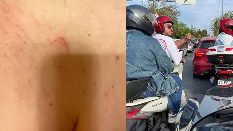Gazeteci Seran Vreskala ve erkek arkadaşı trafikte 4 kişi tarafından saldırıya uğradı