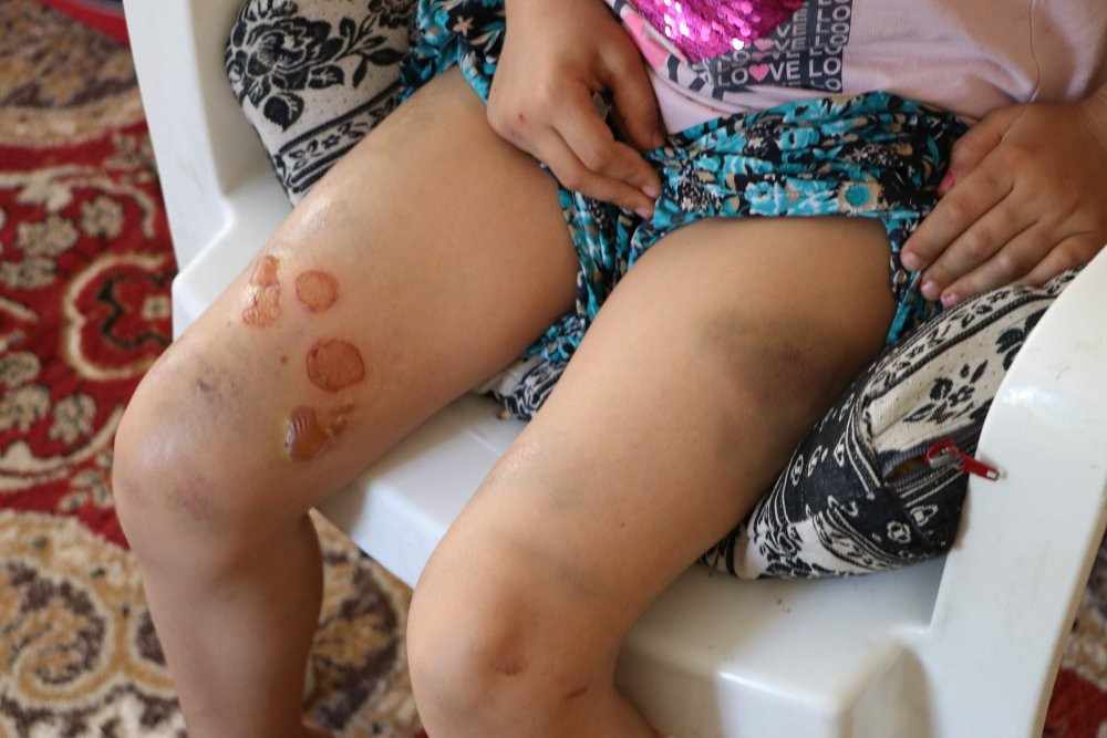 Evde muska bulunca eşine ve çocuklarına işkence yaptı - Resim : 1