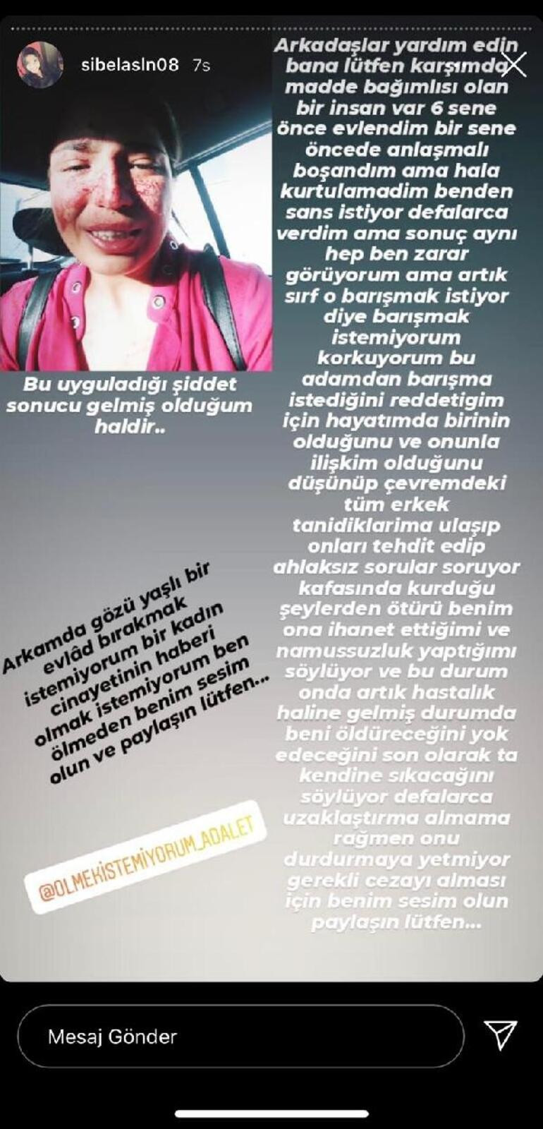 Eski eşinden şiddet gören Sibel, yardım istedi: Arkamda gözü yaşlı bir evlat bırakmak istemiyorum - Resim : 1