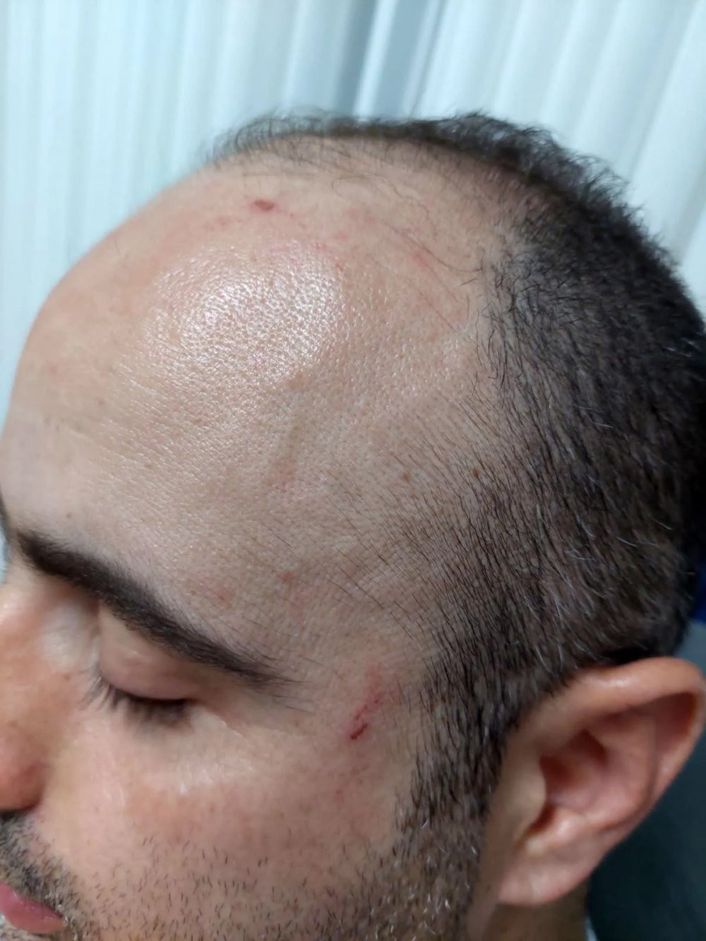 Sağlık ekibine kaldırım taşı ile saldırdı - Resim : 1