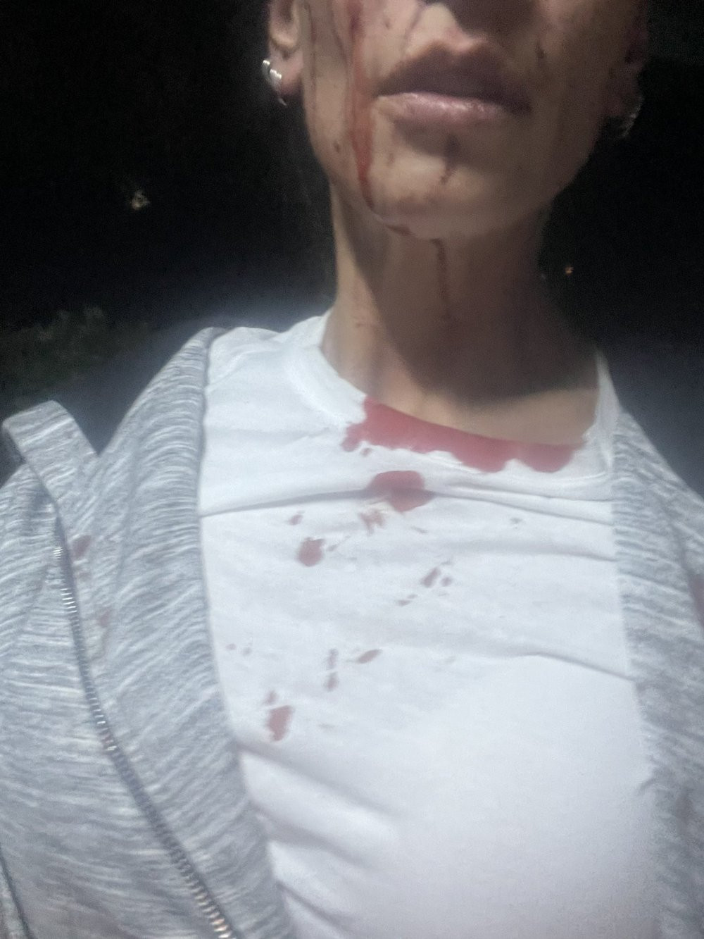 Bahçeşehir'de kadınlara 4-5 kişilik grup 'bira içiyorsunuz' diyerek saldırdı - Resim : 3