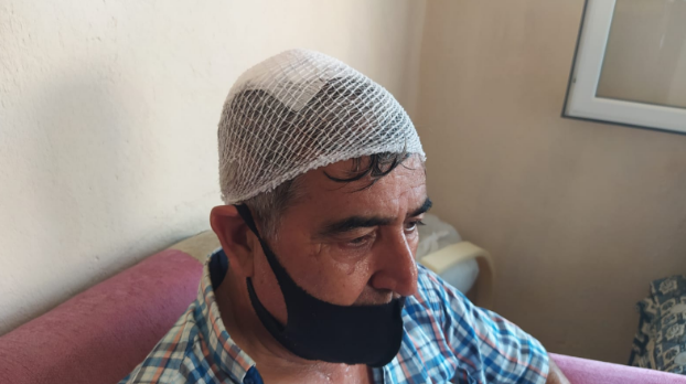 Maskesiz alamayacağını söylediği için otobüs şoförünü darbettiler - Resim : 1