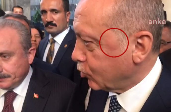 Erdoğan'ın yüzüne ne oldu? - Resim : 1