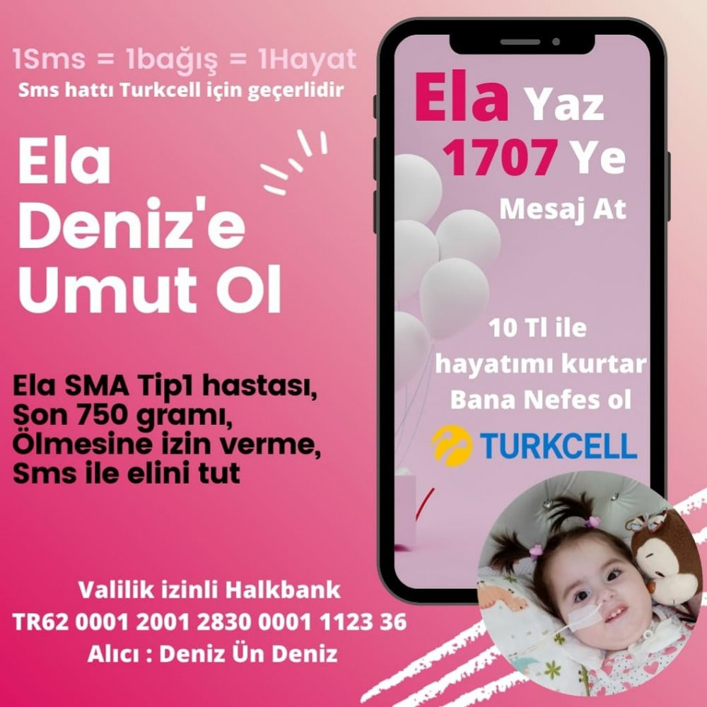 Ela bebek için umut ışığı doğdu - Resim : 1