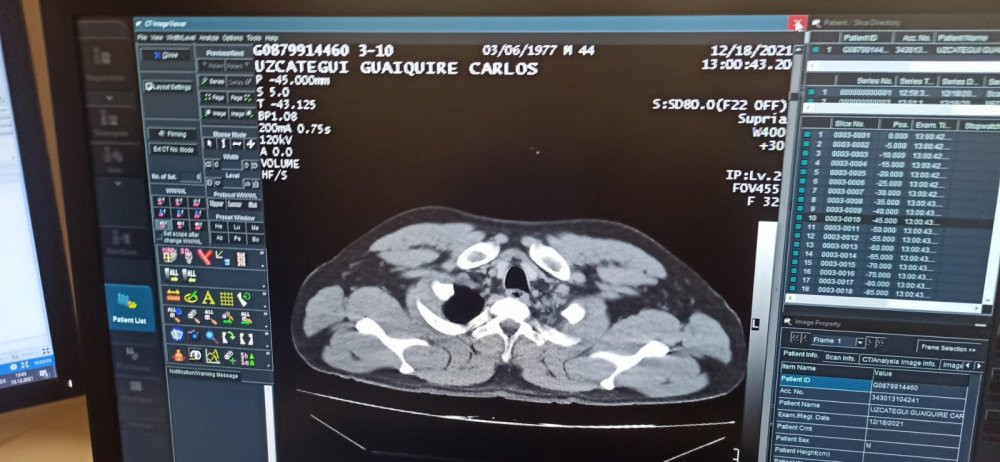 İstanbul Havalimanı'nda Venezuela'dan gelen uyuşturucu kuryesi bayılınca yakalandı - Resim : 2