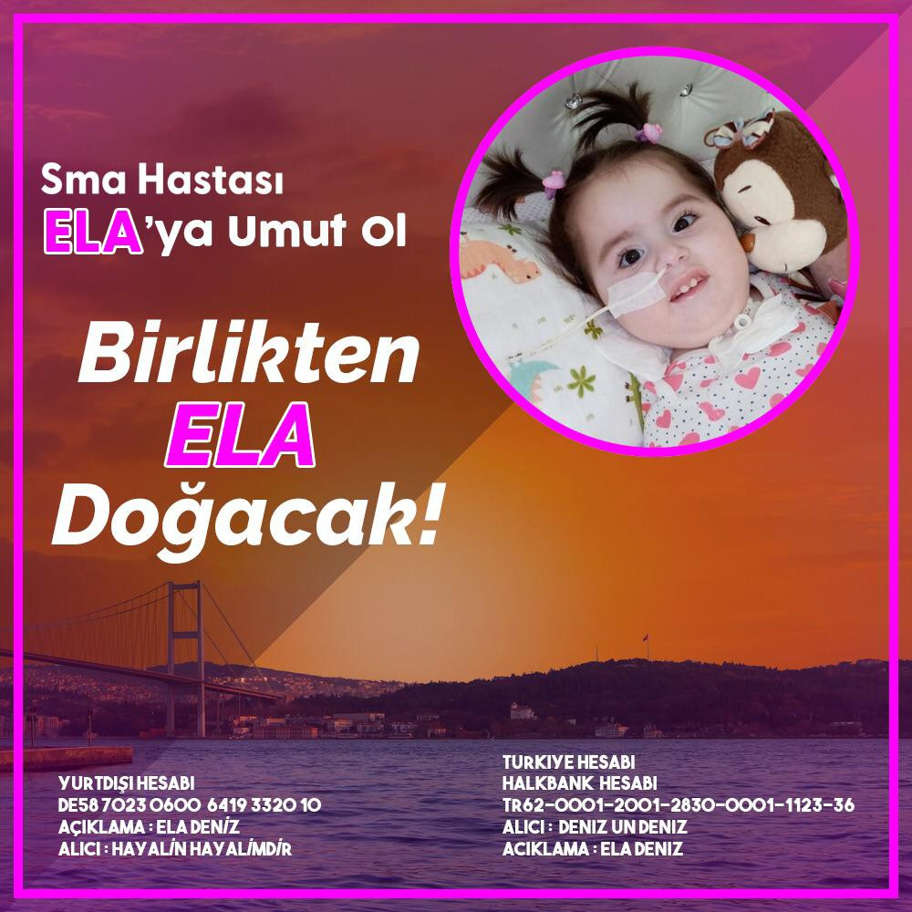 Ela bebek için umut ışığı doğdu - Resim : 2