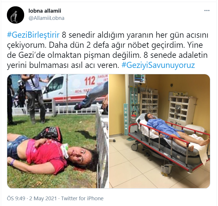 Gezi'de başından gaz fişeği ile yaralanan Lobna Allami: 8 senedir aldığım yaranın her gün acısını çekiyorum, yine de pişman değilim - Resim : 1