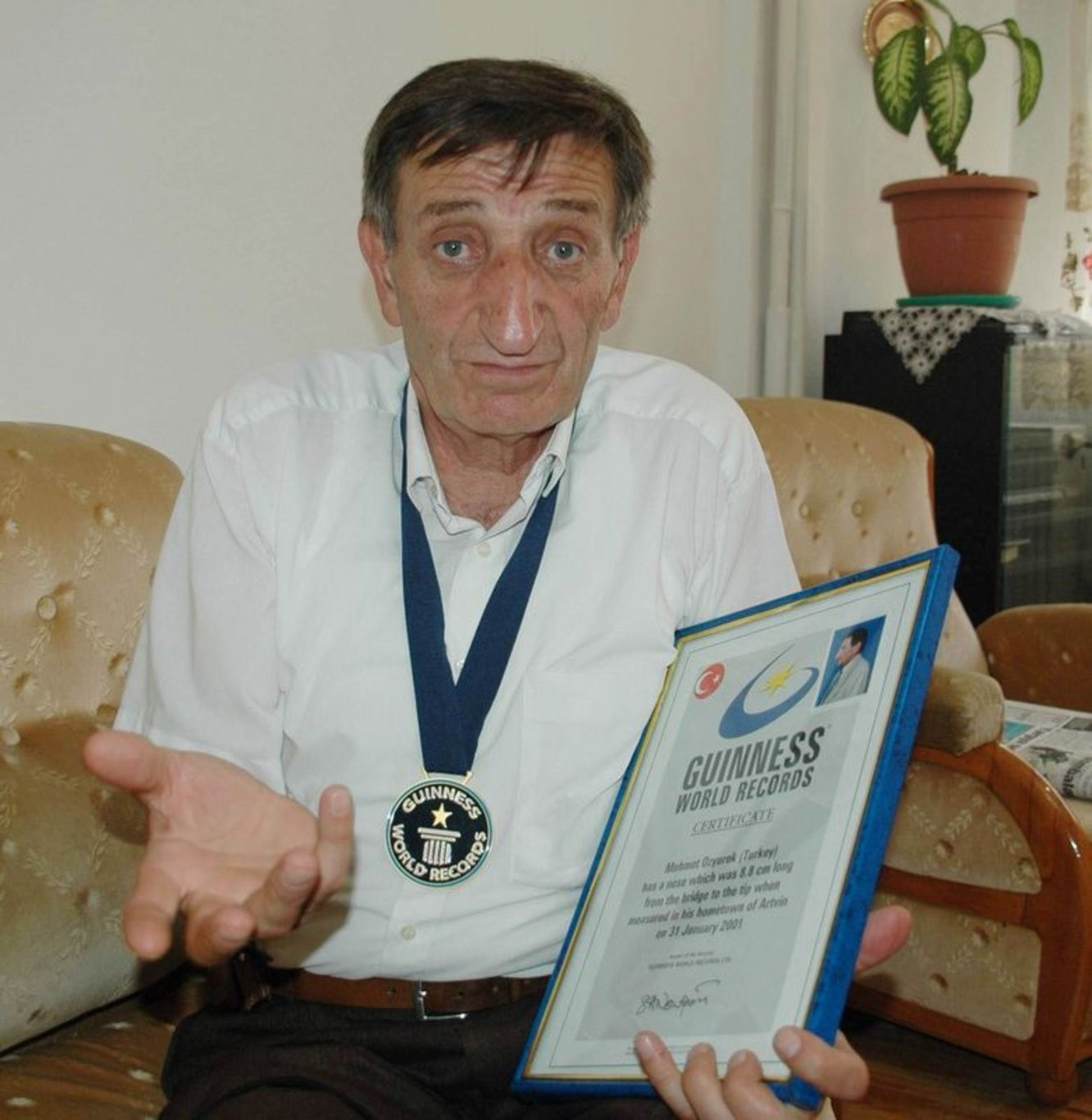 Dünyanın en uzun burunlu adamı Artvinli Mehmet Özyürek yaşamını yitirdi - Resim : 2