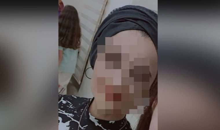 Kayseri'de 23 yaşındaki kadın kendini asarak intihar etti - Resim : 1