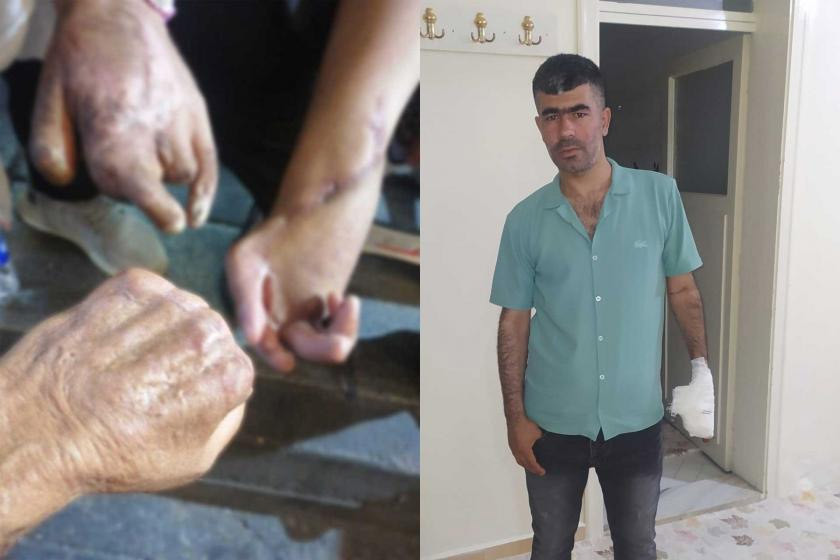 Gaziantep'te 9 işçinin elini kaybettiği fabrika açıklama yaptı - Resim : 1